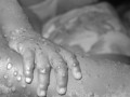  عمان اليوم - اتهام عالِمين أميركيين بمحاولة تهريب فيروس جدري القردة من أفريقيا إلى الولايات المتحدة